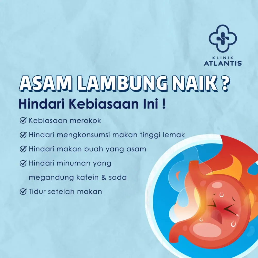 Panduan Lengkap Obat Asam Lambung: Solusi Tepat untuk Perut yang Bahagia